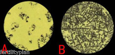 Résultat du test d'ovulation salivaire julia